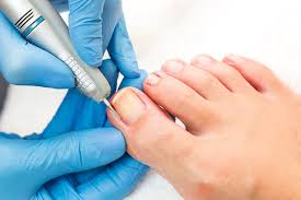 Nail Surgery